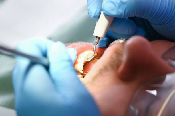 Best Emergency TMJ Treatment in Frederick, OK