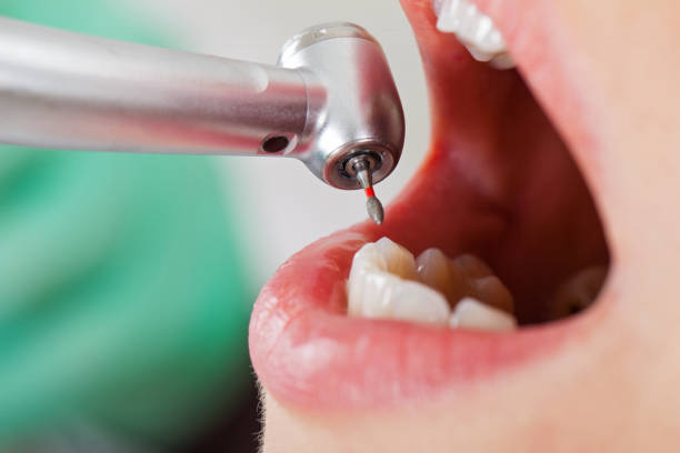 Best Pediatric Emergency Dentist in Frederick, OK